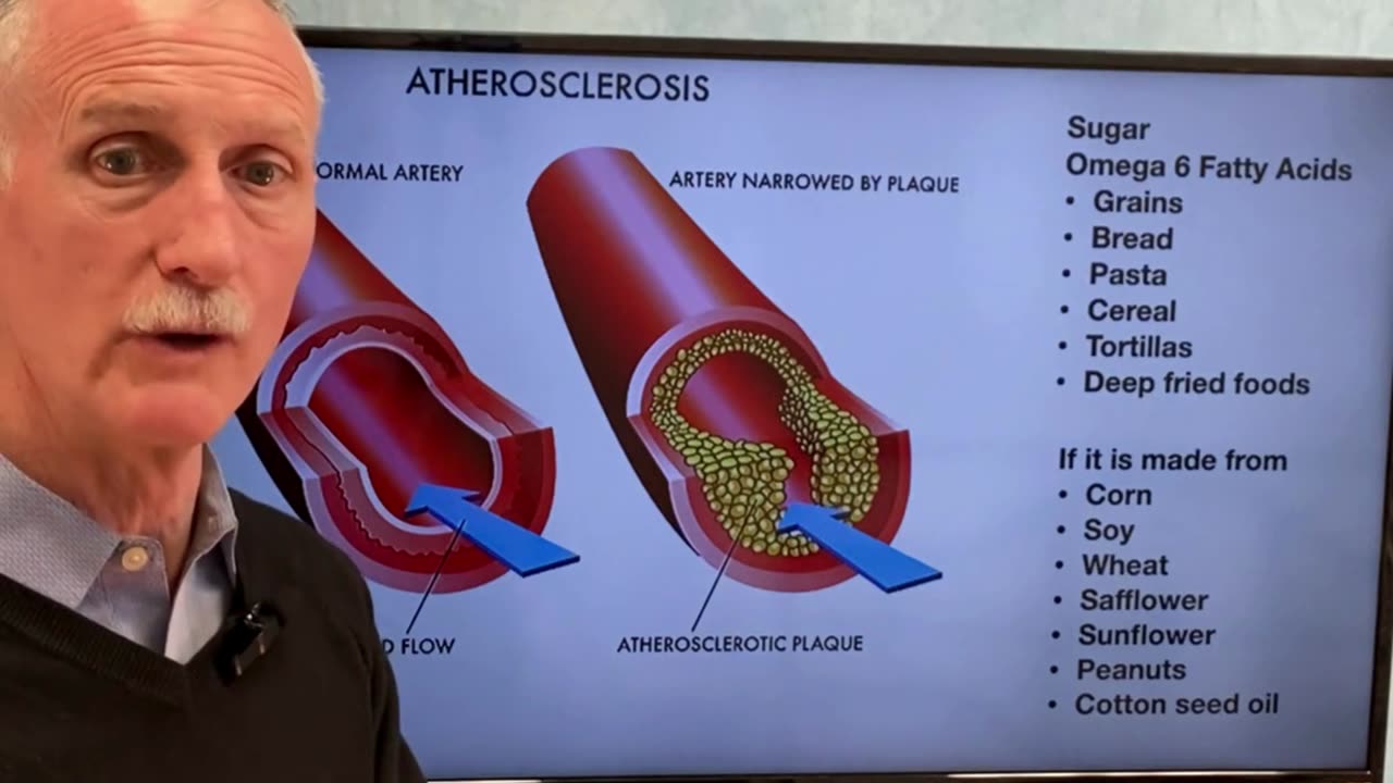 Heart Disease: The Real Cause