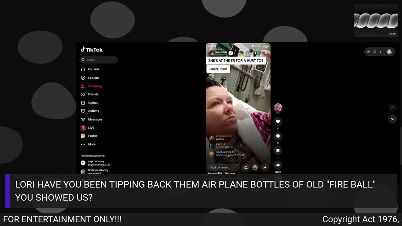 LORI JONES 4/20/25 BROKEN BIG TOE & STREAMING IN THE E.R FOR SYMPATHY??