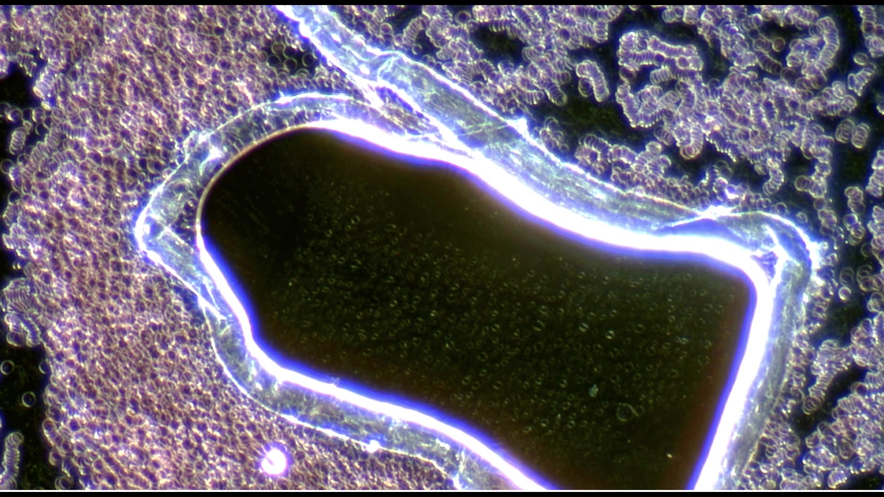 Global Healings EDTA pulling metals and Actuators/Activators in Urine
