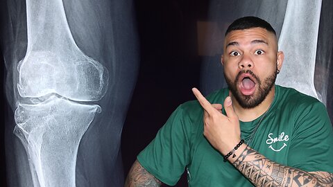 Torn ACL? Here’s Every Surgery Option You Need to Know