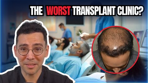 🚨 Hair Transplant Nightmares EXPOSED! 🚨 WATCH THIS Before You Book a Clinic!