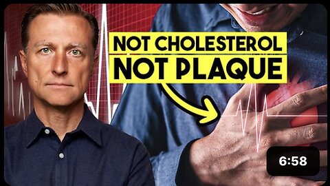 "Unveiling the Hidden Cause Behind 80% of Heart Attacks and Strokes"