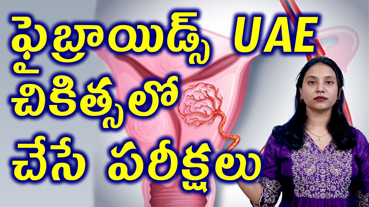 ఫైబ్రాయిడ్స్ UAE చికిత్సలో పరీక్షలు Tests for Fibroids Uterine Artery BloodBlocking or Embolization
