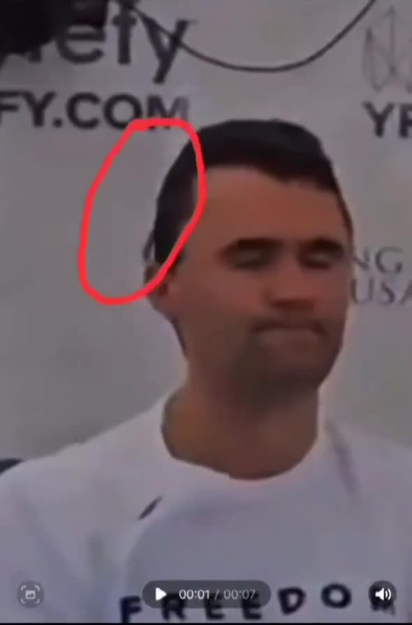 Is the "entry wound" ACTUALLY the exit wound? 🧐