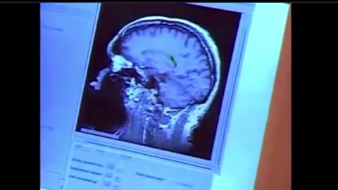 Cancer Apparatus Status