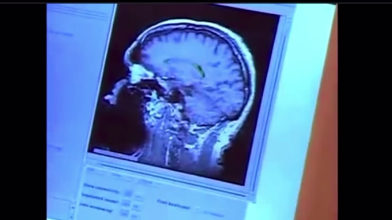 Cancer Apparatus Status
