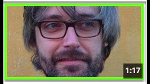 "MEDSCAPE Editor Dies from Vaccine-Induced Seizure"