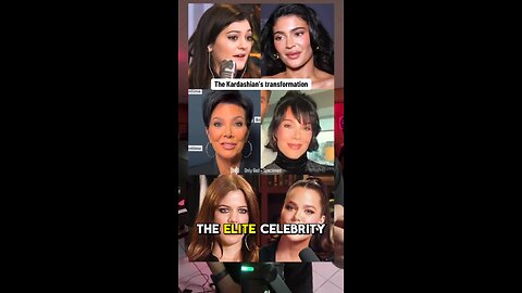 Kris Jenner’s Adrenochrome Makeover EXPOSED – The Kardashian Curse is Real