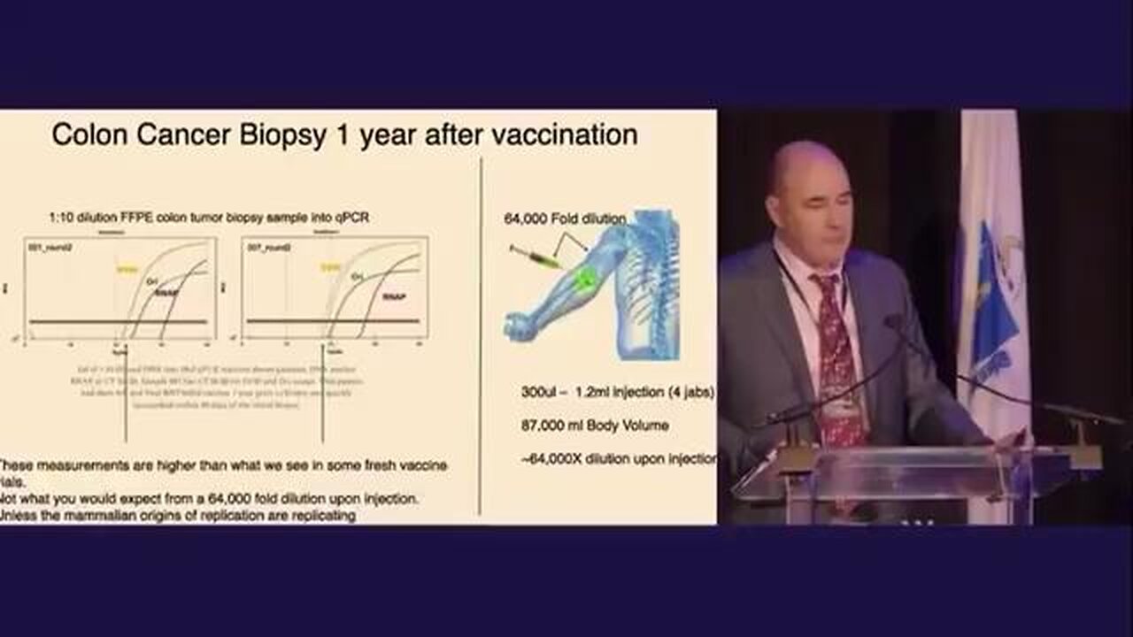 Colon Cancer Biopsy 1 year after vaccination. What they don’t want you to know