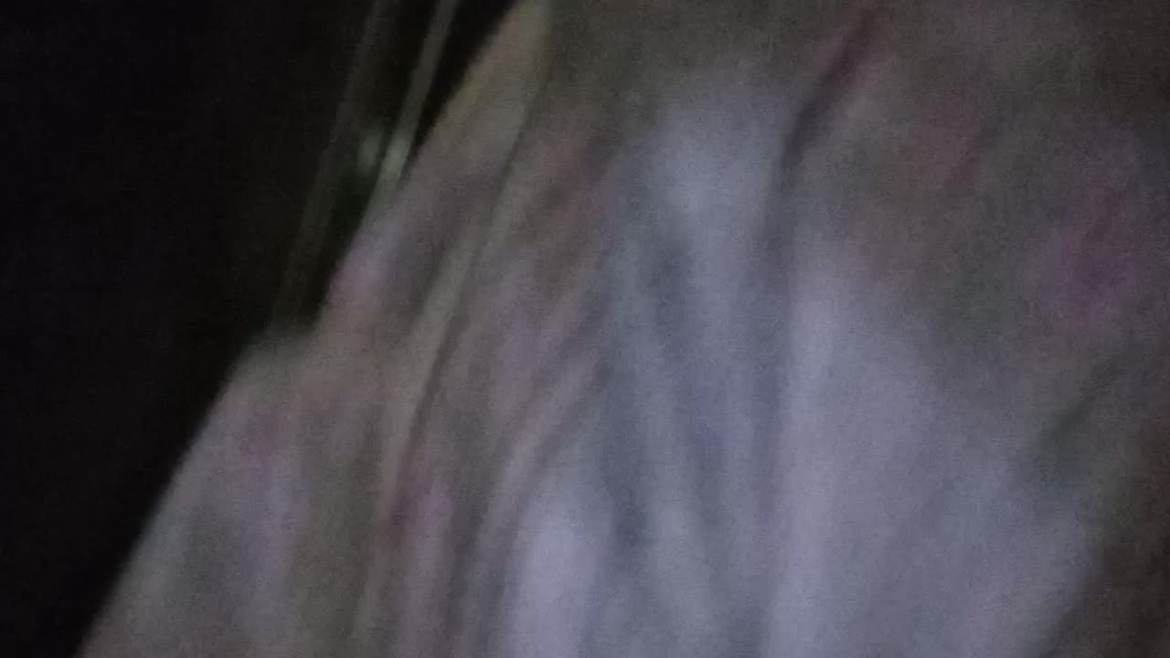 Pt 2 seizures itchiness and more