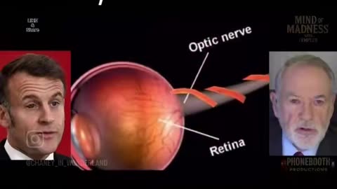 Have you heard of the Vril that the elite insert into the eyeball?