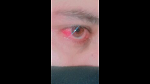 Pain full eyes
