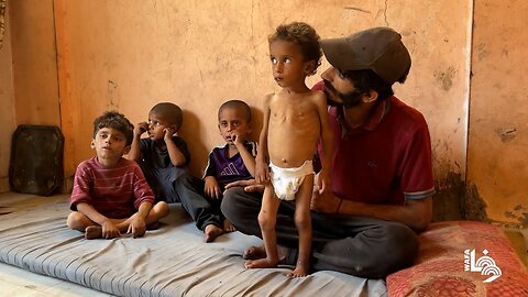 Gaza Child Yazan Abu Foul Faces Severe Malnutrition Amid Israeli Blockade and Food Shortage