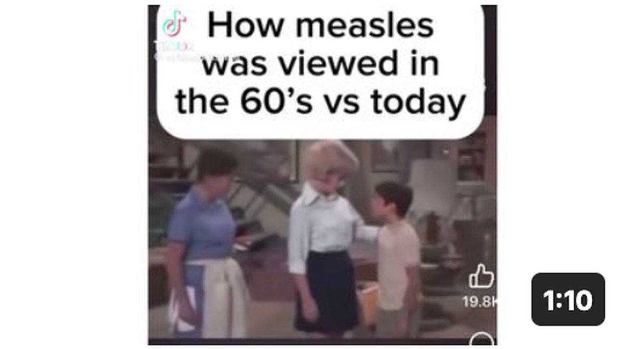 Measles today vs the 60’s 🤣🤣🤣
