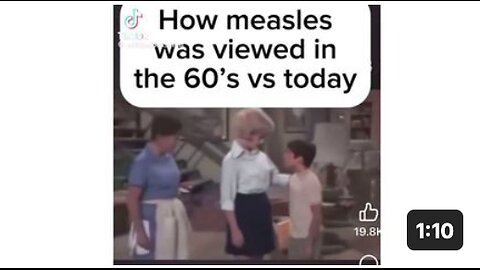 Measles today vs the 60’s 🤣🤣🤣