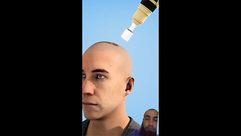 Neuralink Project Explained | Insaan Ko Robot Banane Ki Tayari 🤖🧠