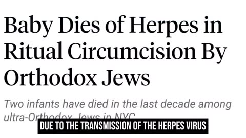 Metzitzah b'peh is a jewish circumcision ritual