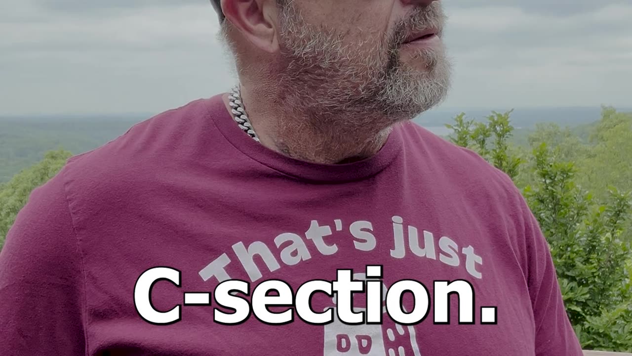 C-Section