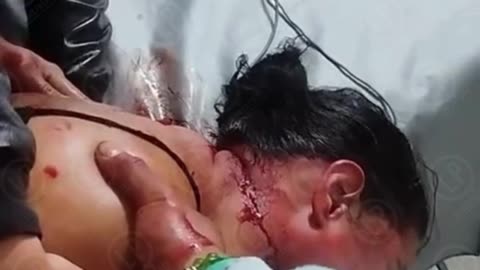 Mujer fue apuñalada durante riña en parque principal de El Cerrito, Santander