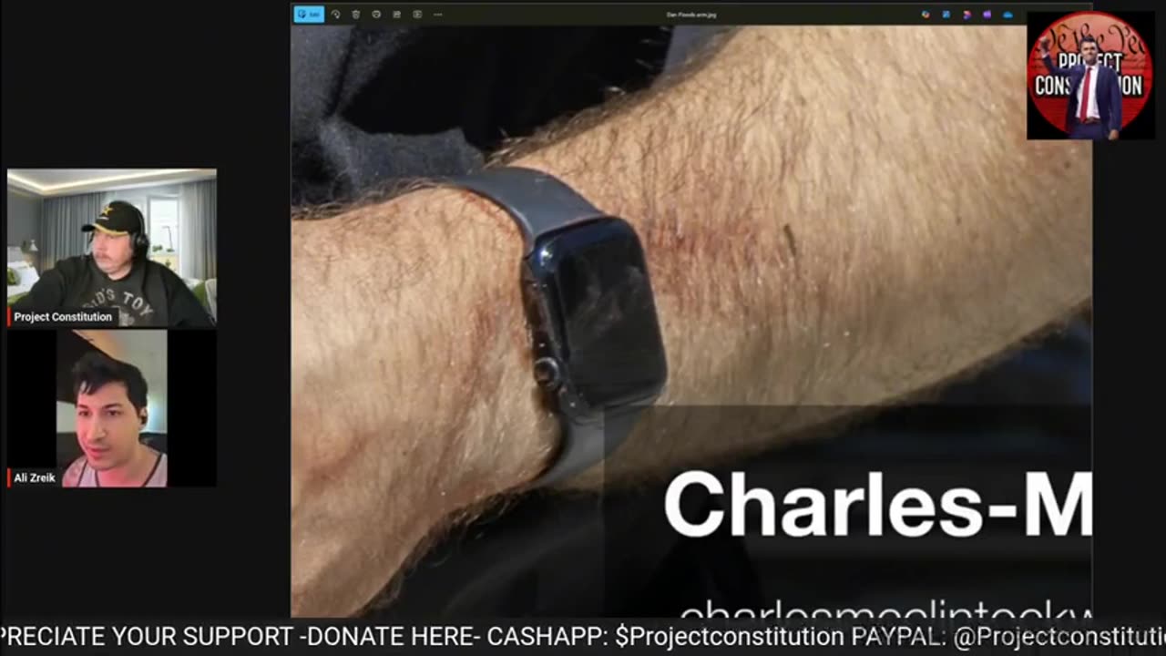 Dan Flood Was INJURED by Shrapnel From SAME Exploding Mic Blast That Killed Charlie