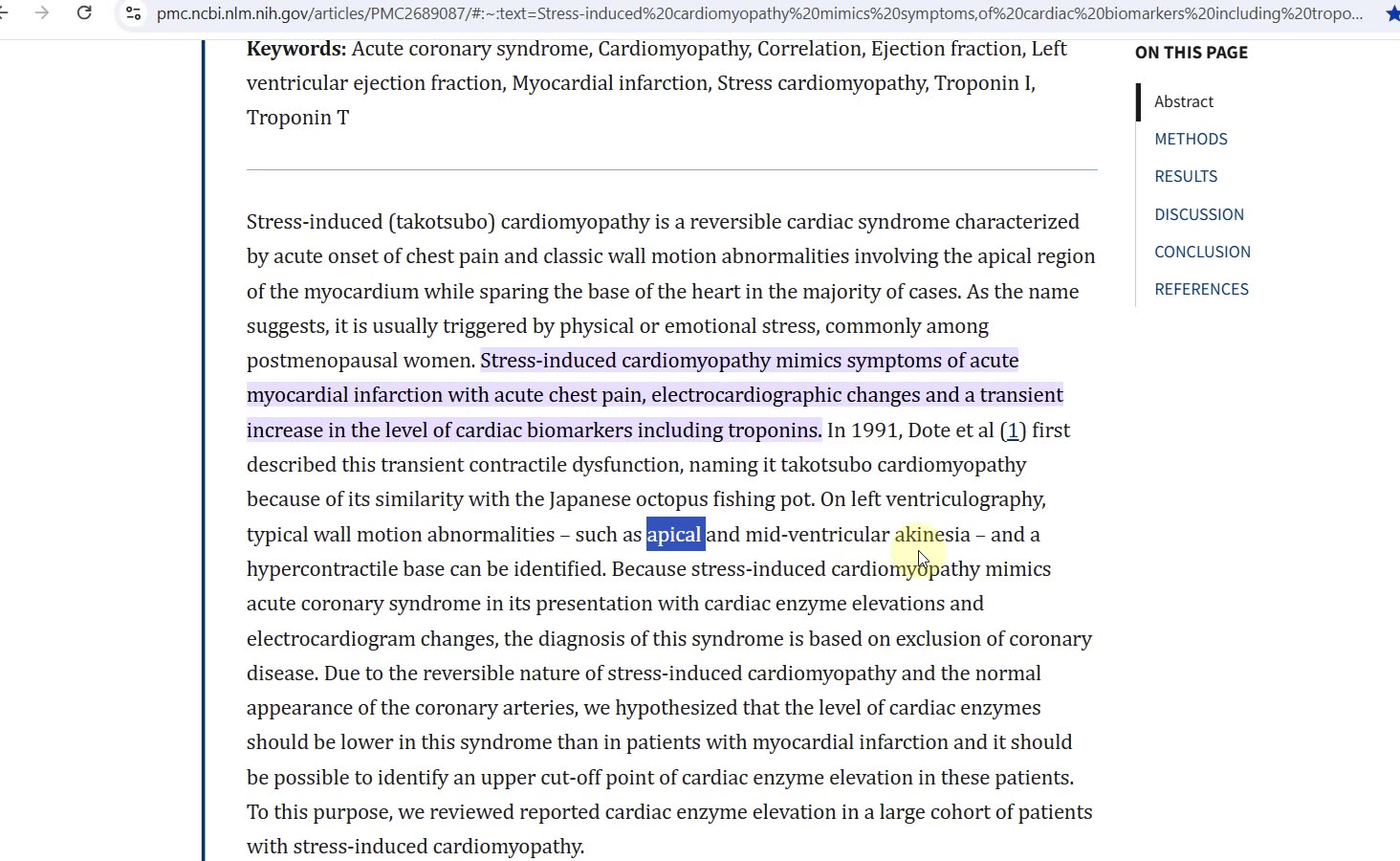 Health Podcast Elevated Troponin - Causes, False Diagnosis