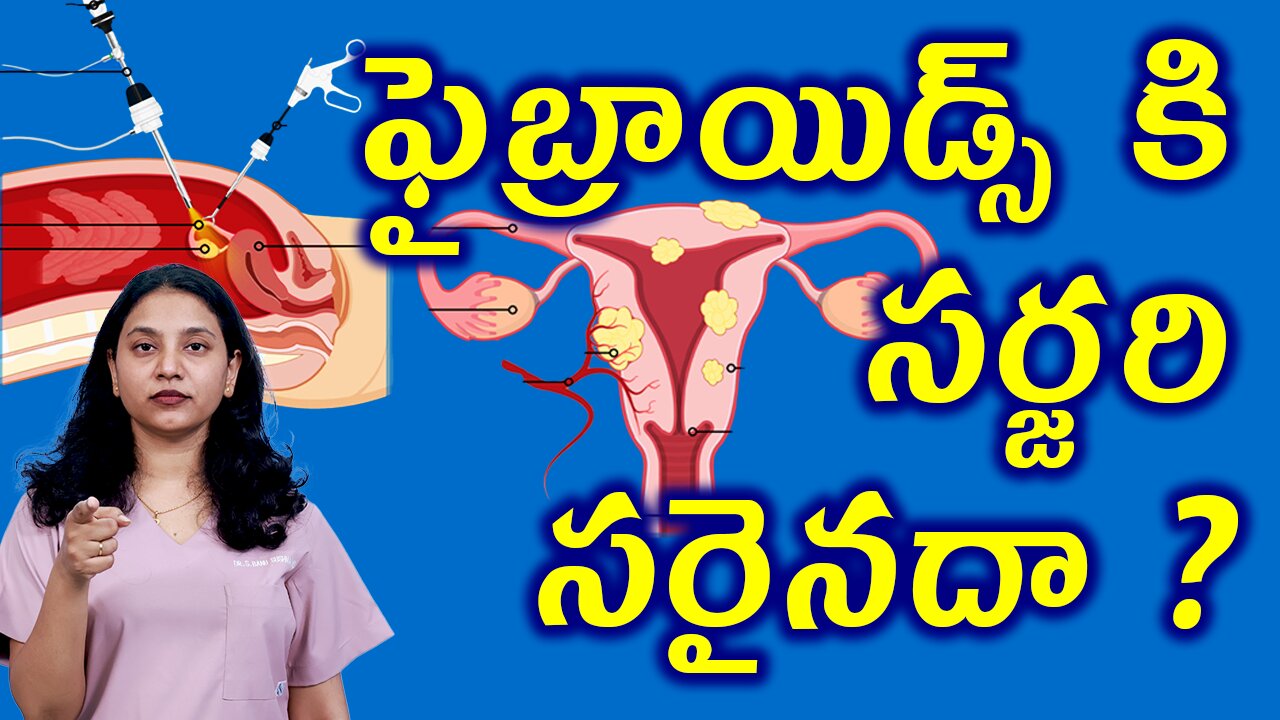 ఫైబ్రాయిడ్స్ కి సర్జరీ సరైనదా? Myomectomy Surgery or Uterus Fibroids Removal operation Homeopathy