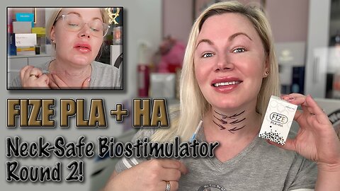 Fize PLA + HA : New Biostimulator for Youthful Neck! AceCosm.com and Code Jessica10 Saves you money