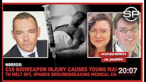 "Terrifying: C19 Bioweapon Incident Inflicts Severe Skin Damage on Young Man"