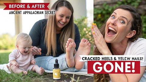 Secret for Healthy, Beautiful Nails & Feet | Cracked Heels & Yellow Nails GONE in 7 Days!"