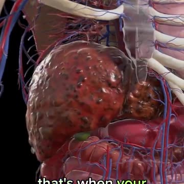 5 signs you have a parasite and how to fix