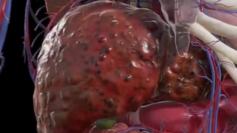 5 signs you have a parasite and how to fix