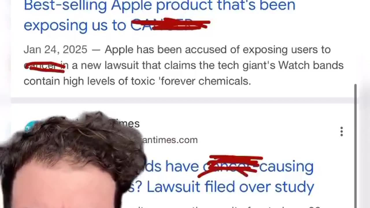 DO YOU WEAR AN APPLE WATCH - HAVE YOU NOTICED A MARK DEVELOP ON YOUR SKIN