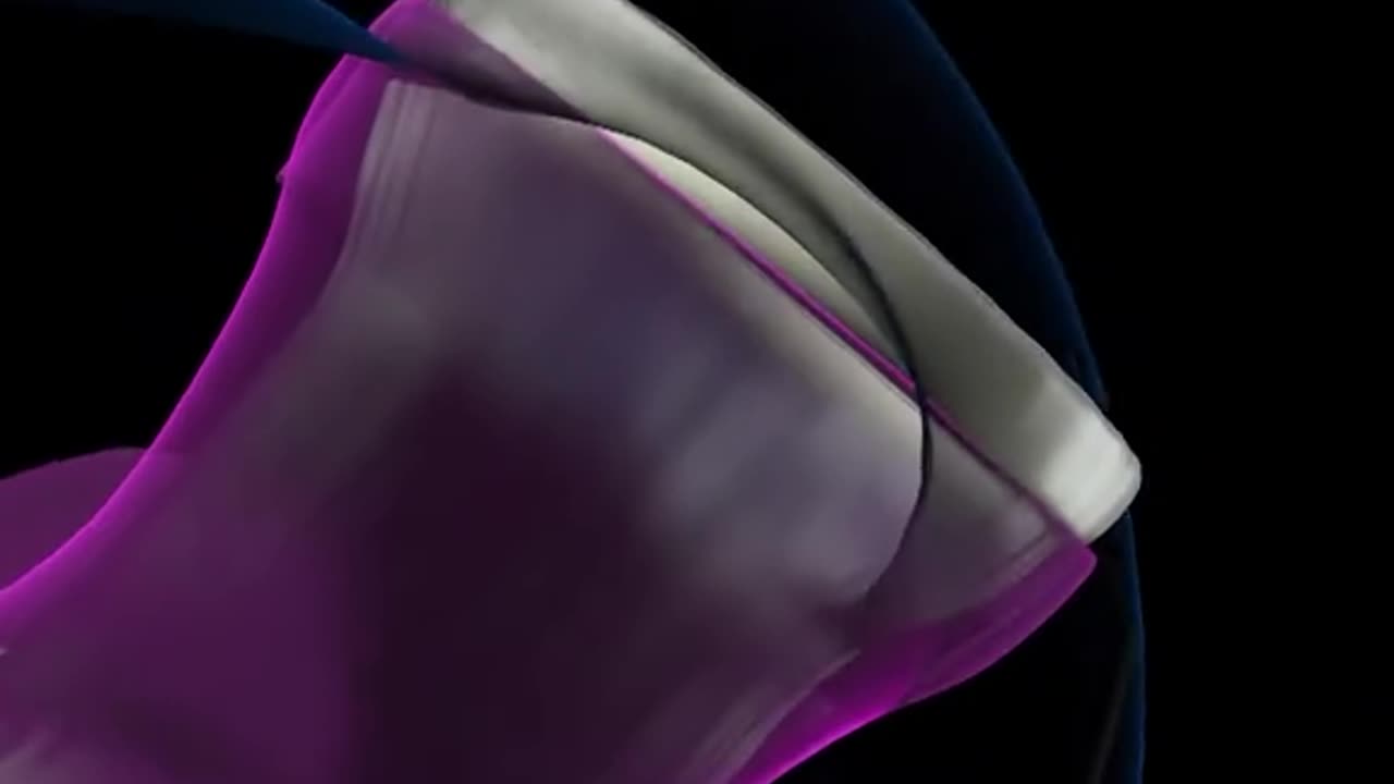 Hysterectomy Procedure 3D Animation