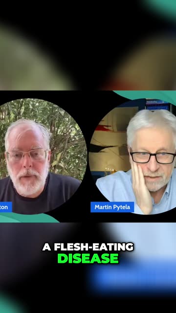 Staph Infection: From Scratch to Coma in 12 Hours!