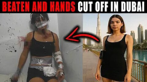 Dubai Parties Exposed: Transgender Model Shares Unbelievable SHOCKING Details! True Crime