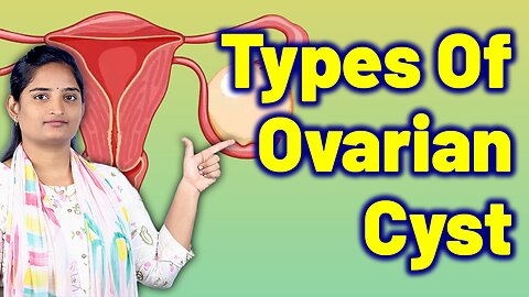 Types Of Ovarian Cyst, Reproductive Cyst, Pelvic Cyst, Dermoid Cyst | Homeopathy Medicine & Surgery