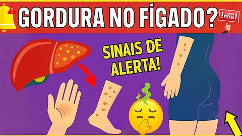 VOCÊ TEM FÍGADO GORDUROSO? 10 Sinais de Alerta + 3 Alimentos que DESTROEM seu Fígado