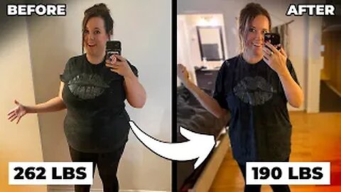 She Lost 72 Pounds in 4 Months… and Has No Loose Skin