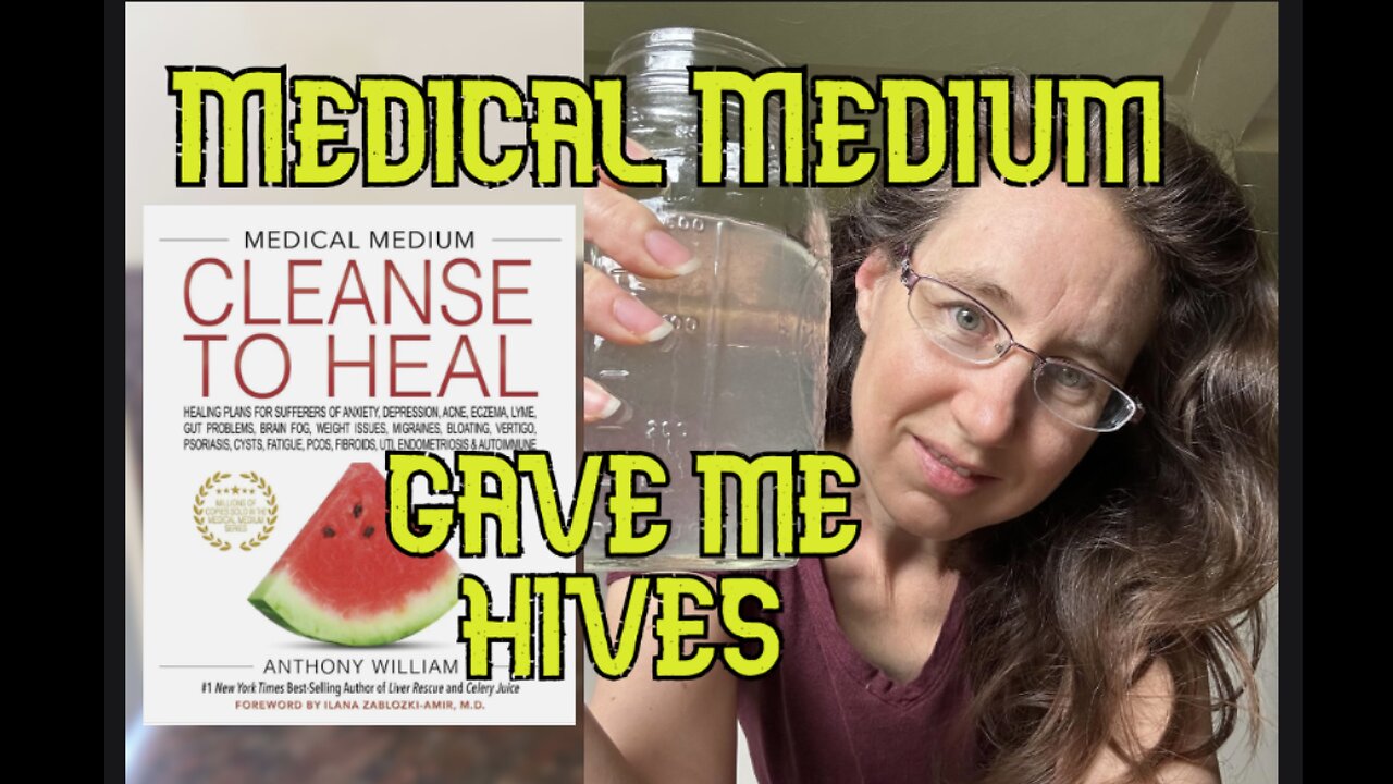 The Medical Medium Diet Gave Me Hives - WHAT SHOULD YOU DO?