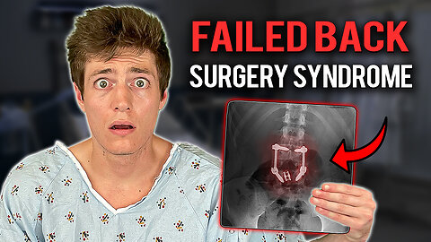 How I Almost Died From 3 Back Surgeries!