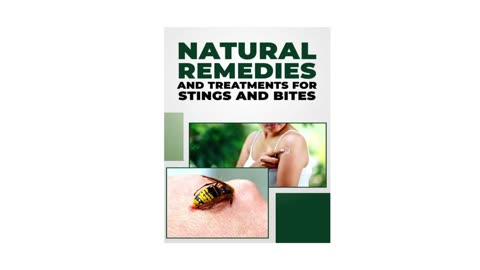 NATURAL REMEDIES AND TREATMENTS FOR STINGS AND BITES
