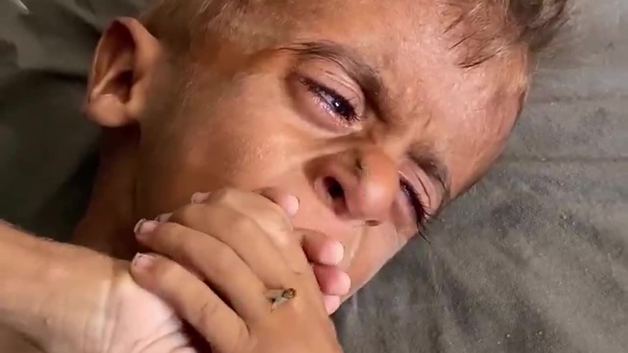 Gaza: Baby Mohammed Al-Matouq is in the final stages of starvation