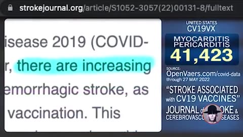 WOMAN DESTROYED BY VAX POISON INDUCED CARDIAC ARREST BLOOD CLOTS