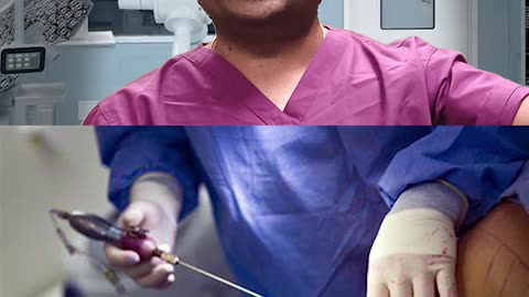 Tummy Tuck Surgery Explained: Liposuction, Skin Removal & Belly Button Repositioning @evolvecosmeticclinic