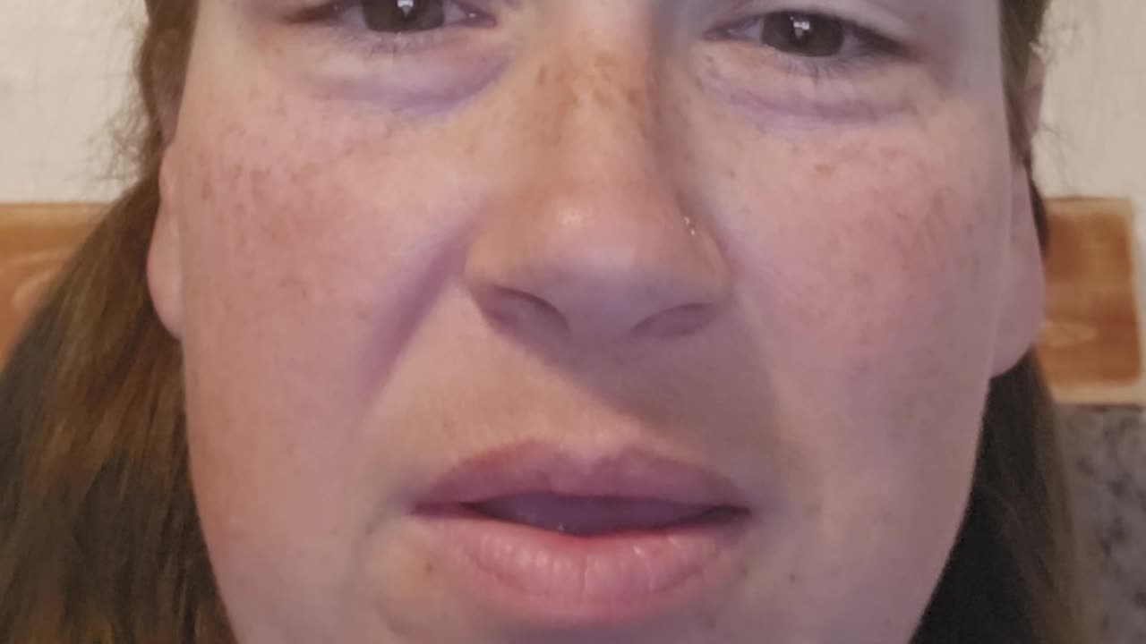 The Cross & Resurrection — Why the Resurrection Matters