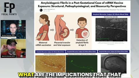 Red Alert Issued as Fibrous Clots Found in Young Children of Covid-Vaxxed Mothers