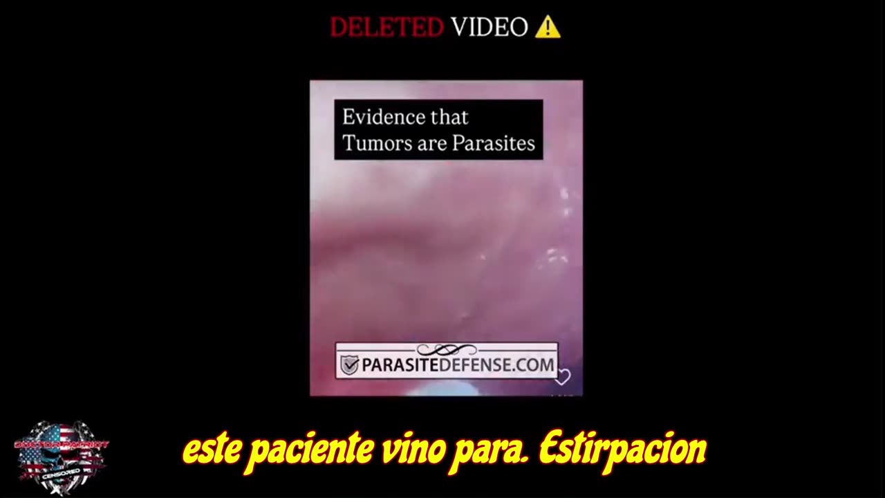 ¡Evidencia de que los tumores, también conocidos como cáncer, son parásitos! .......