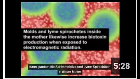 "Dietrich Klinghardt: WiFi Encourages Mould Growth and May Cause Autism"