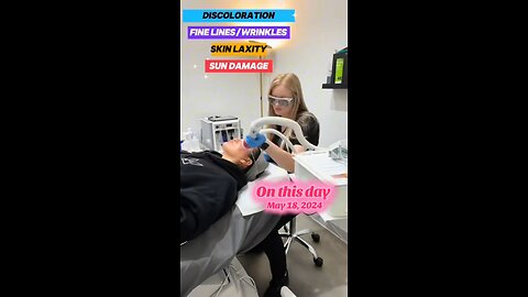 On This Day..One Year Ago Today 💁🏻‍♀️Fresh Faces Rx