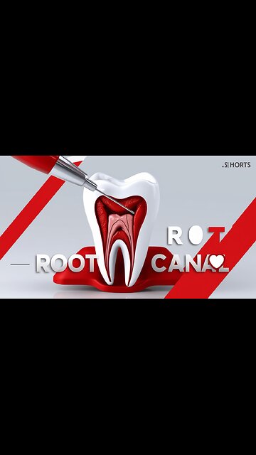 “What Is a Root Canal? 😳 | Dental Procedure Explained #Shorts” 👇